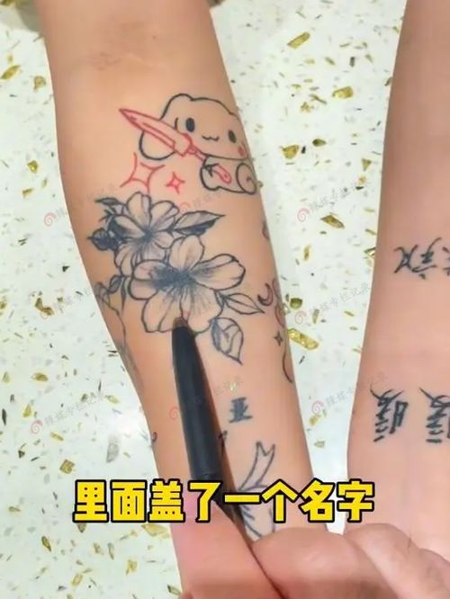 纹身可以去掉吗？揭秘纹身去除的最新技术与发展